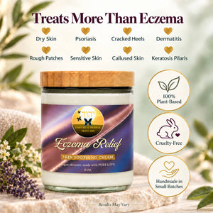 Eczema Relief herbal moisturizer for dry skin